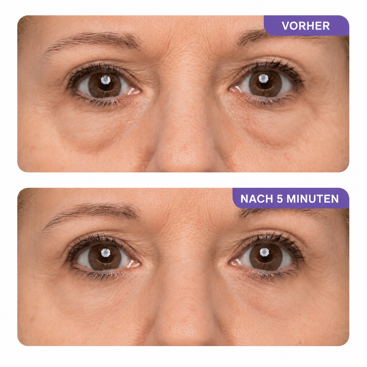 MeleaSkin Collagen Augen Gel