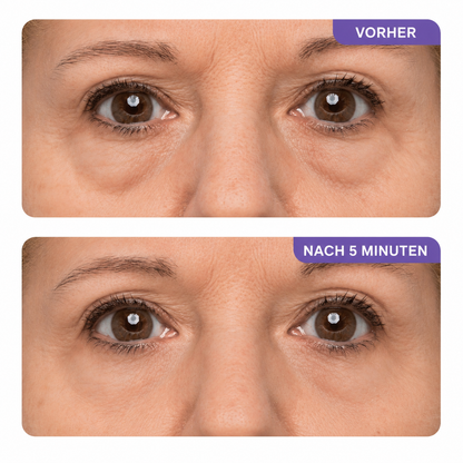 MeleaSkin Collagen Augen Gel